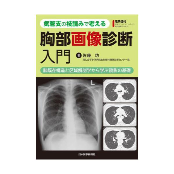 即戦力が身につく骨軟部の画像診断 MEDSi)株式会社 メディカル・サイエンス・インターナショナル
