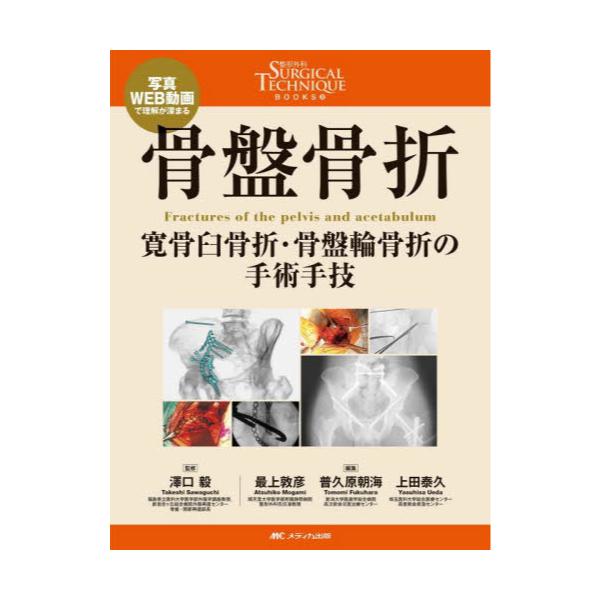 書籍 骨盤骨折 寛骨臼骨折 骨盤輪骨折の手術手技 写真 Web動画で理解が深まる 整形外科surgical Technique Books 9 メディカ出版 キャラアニ Com